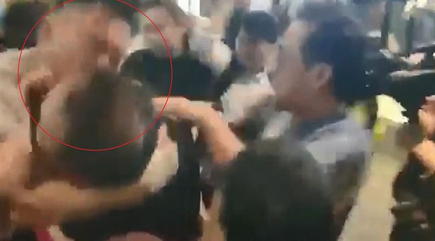 Hong Kong’da hükümet yanlısı bir kişi, meclis üyesinin kulağını ısırarak kopardı