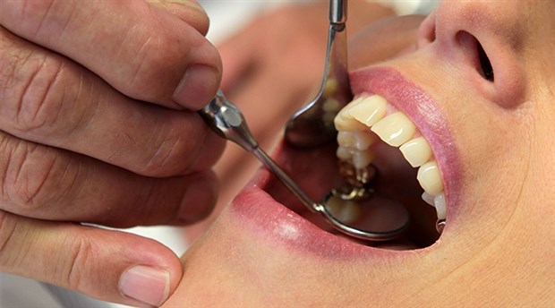 20 yaş dişleri için yıllık kontrol şart