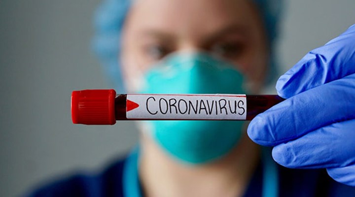 Japonya koronavirüs tedavisinde kullanılacak ilaç için çalışmalara başladı