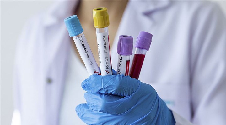 İstanbul'da özel laboratuvar koronavirüs sonuçlarını bakanlığa vermemiş