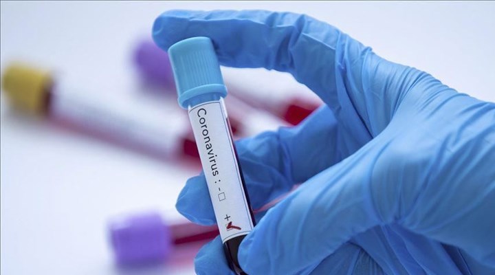 ABD'de yapılan koronavirüs testlerinin sayısı 2 milyonu aştı