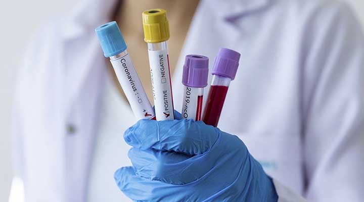 ABD Enfeksiyon Hastalıkları Enstitüsü Başkanı Dr. Fauci: Antikor testleri bir hafta gibi bir sürede hazır olacak