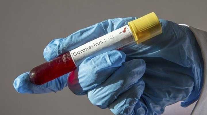 Kuzey Kıbrıs'ta bir haftadır koronavirüs vakası yok