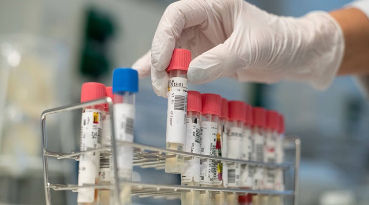 New York Valisi, eczanelere koronavirüs testi yapma yetkisi verdi