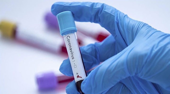 İngiltere’de sağlık çalışanlarına gelecek haftadan itibaren antikor testleri uygulanacak