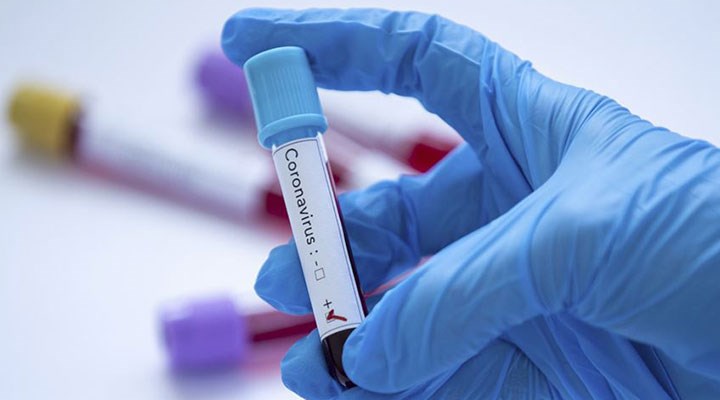 Yeni Malatyaspor’da 5 kişide koronavirüs tespit edildi