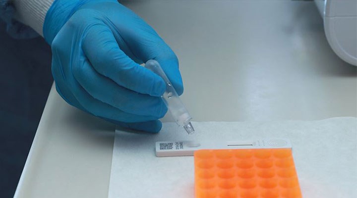 Sağlık Bakanlığı'ndan koronavirüs testlerine ilişkin yeni karar: Kriterler değişiyor