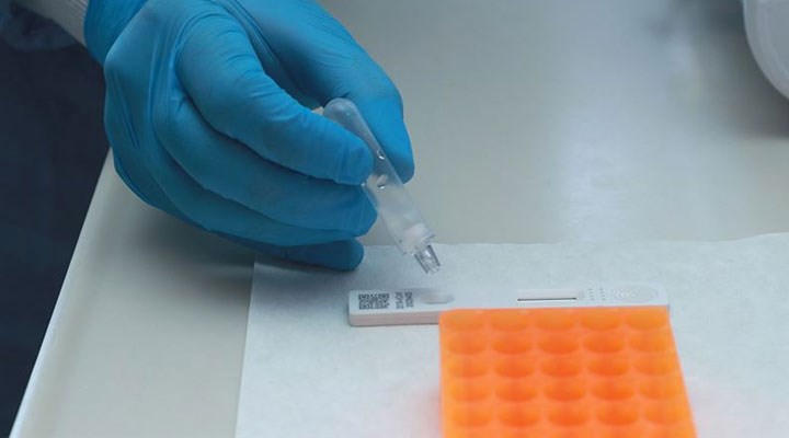 Antikor testlerinin yapılacağı iller açıklandı