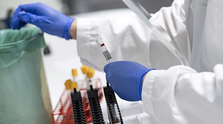 Şanlıurfa İl Sağlık Müdürlüğü: PCR testleri için kullanılan kitler arızalı çıktı