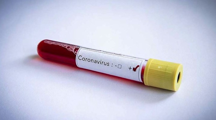 "Koronavirüs hastalarına verilen ilaçlar kalp hasarına neden oluyor" iddiası Meclis gündeminde