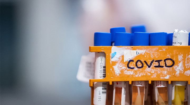 ABD'de geçen yıl bağışlanan kanlarda Covid-19'a karşı oluşmuş antikorlar bulundu