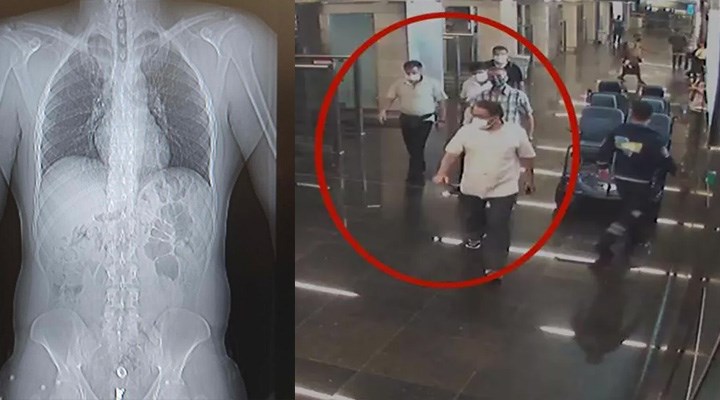 İstanbul Havalimanı'nda durdurulan 3 turistin midesinden 3 kilo eroin çıktı