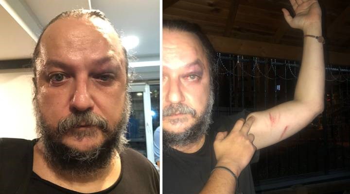 BirGün gazetesi yazarı Güvenç Dağüstün saldırıya uğradı