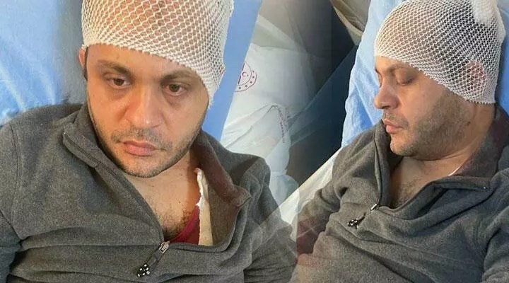 Antep'te doktora mermerle saldıran hasta yakını tutuklandı