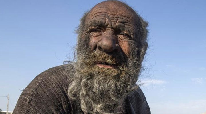 İran'da, hasta olma korkusuyla 50 yıldan fazla süredir yıkanmayan adam hayatını kaybetti