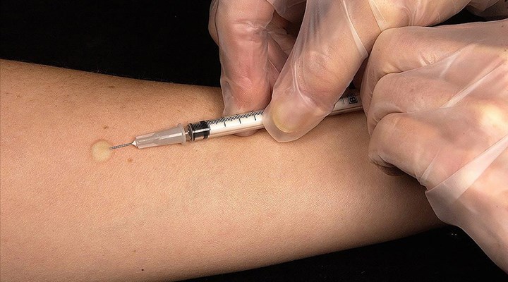 Ülkede kuduz aşısı kaosu