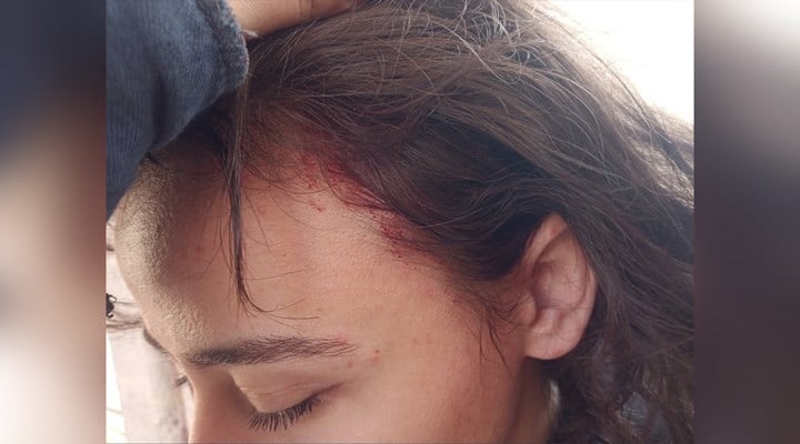 İÜ’de faşist saldırı: Bir kadın öğrencinin kafasına soda şişesi atıldı