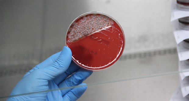 uzun-sure-kullanilan-maskedeki-bakteriler-laboratuvarda-gozler-onune-serildi-796684-1.