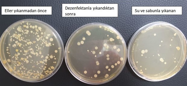 uzun-sure-kullanilan-maskedeki-bakteriler-laboratuvarda-gozler-onune-serildi-796685-1.