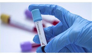 ABDde yapılan koronavirüs testlerinin sayısı 2 milyonu aştı