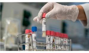 Çin ve ABDde üç potansiyel koronavirüs aşısının klinik denemeleri sürüyor