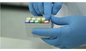 DSÖ, Covid-19a karşı kullanılan sıtma ilacının klinik araştırmalarını askıya aldı
