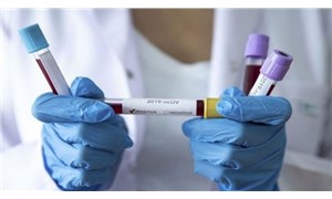 Araştırma: Yeni tip koronavirüs kan yoluyla bulaşır mı?