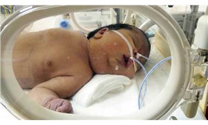 Doğum raporunda ‘erkek’ yazan bebeğin cinsiyetinin kız olduğu ortaya çıktı