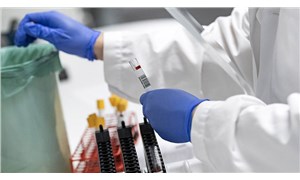Şanlıurfa İl Sağlık Müdürlüğü: PCR testleri için kullanılan kitler arızalı çıktı