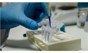 Yerli aşı çalışmalarında son durum: İnsan üzerinde denemeler başlıyor