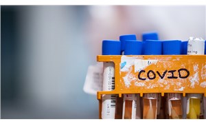 ABDde geçen yıl bağışlanan kanlarda Covid-19a karşı oluşmuş antikorlar bulundu