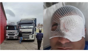 TIRlar soyuluyor, şoförler saldırıya uğruyor: Türkiyeli TIR şoförü sol gözünü kaybetti