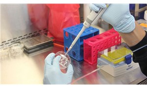 Bilim Kurulu Üyesi Yavuz: PCR dışında testlerin çeşitlendirilmesi şart