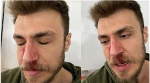 İzmir'de darp edilen asistan doktorun burnu kırıldı!