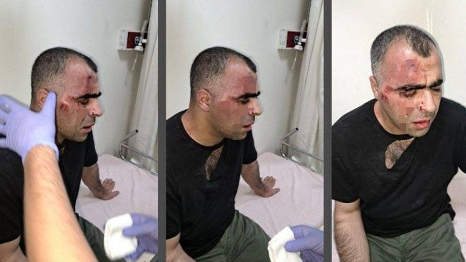 Gazeteci Sinan Aygül'e saldıran korumalar tutuklandı