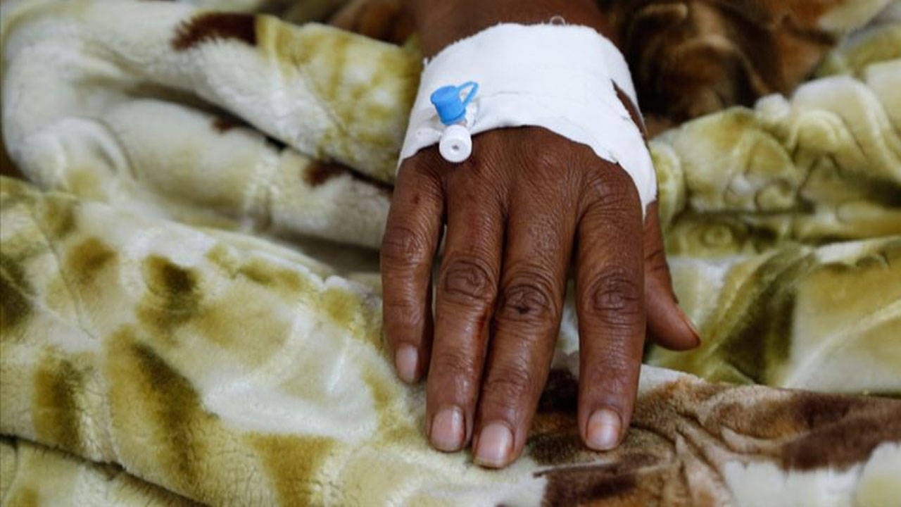 Zimbabve'de kolera salgını: 100'ü aşkın şüpheli ölüm, 5 binden fazla vaka