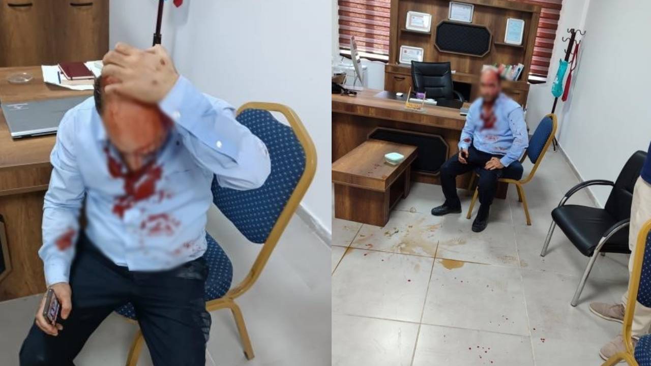 Şanlıurfa’da okul müdürü saldırıya uğradı