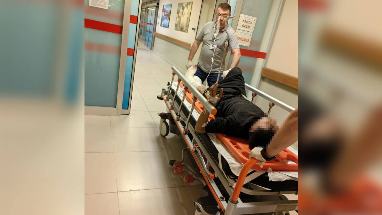 Bursa’da mobilya imalathanesinde çalışan 15 yaşındaki çocuğun bacağı parçalandı
