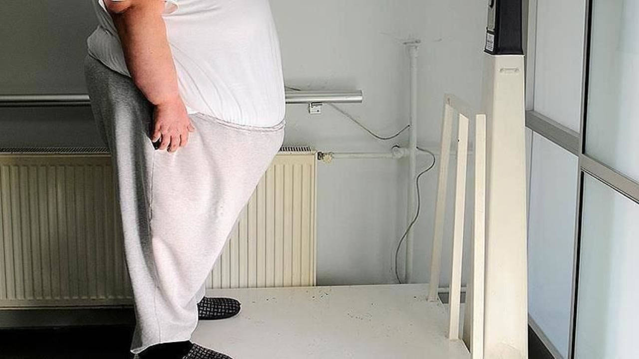 TTB: Obezite yoksulluk hastalığıdır