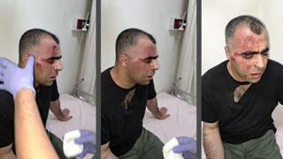 Kılıçdaroğlundan saldırıya uğrayan gazeteci Sinan Aygüle geçmiş olsun telefonu